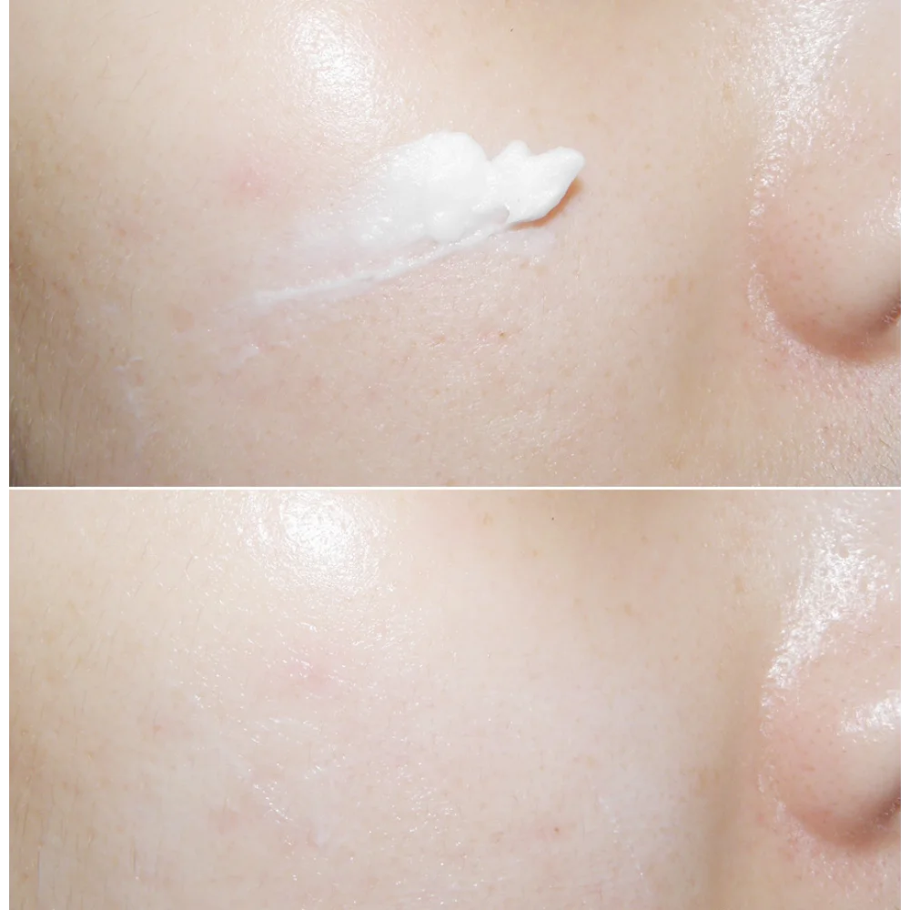 Korea Mizon Skin Recovery Nigh - مراجعة Luxury Skincare Essence وسعره
